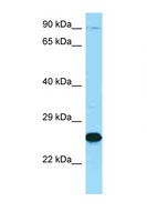 MME / CD10 Antibody - MME / CD10 antibody Western blot of 3 Cell lysate. Antibody concentration 1 ug/ml.  This image was taken for the unconjugated form of this product. Other forms have not been tested.