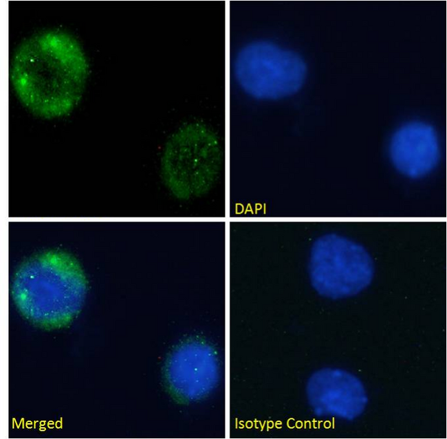MME / CD10 Antibody - IF staining of Jurkat cells.