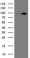 MME / CD10 Antibody - HEK293T cells were transfected with the pCMV6-ENTRY control (Left lane) or pCMV6-ENTRY MME (Right lane) cDNA for 48 hrs and lysed. Equivalent amounts of cell lysates (5 ug per lane) were separated by SDS-PAGE and immunoblotted with anti-MME.