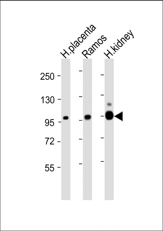 MME / CD10 Antibody - All lanes: Anti-MME Antibody (Center) at 1:4000 dilution Lane 1: Human placenta lysate Lane 2: Ramos whole cell lysate Lane 3: Human kidney lysate Lysates/proteins at 20 µg per lane. Secondary Goat Anti-mouse IgG, (H+L), Peroxidase conjugated at 1/10000 dilution. Predicted band size: 100 kDa Blocking/Dilution buffer: 5% NFDM/TBST.