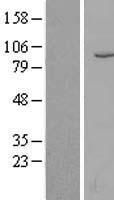 MME / CD10 Protein - Western validation with an anti-DDK antibody * L: Control HEK293 lysate R: Over-expression lysate