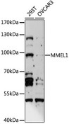 MMEL1 Antibody - Western blot analysis of extracts of various cell lines, using MMEL1 antibody at 1:1000 dilution. The secondary antibody used was an HRP Goat Anti-Rabbit IgG (H+L) at 1:10000 dilution. Lysates were loaded 25ug per lane and 3% nonfat dry milk in TBST was used for blocking. An ECL Kit was used for detection and the exposure time was 90s.