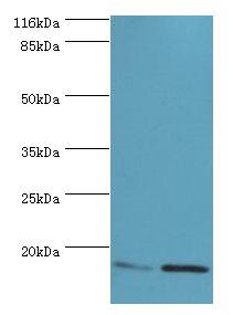 MMGT1 Antibody - Western blot. All lanes: MMGT1 antibody at 12 ug/ml. Lane 1: HeLa whole cell lysate Lane 2: 293T whole cell lysate. Secondary antibody: goat polyclonal to rabbit at 1:10000 dilution. Predicted band size: 15 kDa. Observed band size: 15 kDa.  This image was taken for the unconjugated form of this product. Other forms have not been tested.