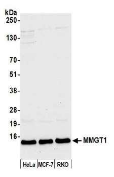MMGT1 Antibody - Detection of human MMGT1 by western blot. Samples: Whole cell lysate (50 µg) from HeLa, MCF-7, and RKO cells prepared using NETN lysis buffer. Antibody: Affinity purified rabbit anti-MMGT1 antibody used for WB at 1:1000. Detection: Chemiluminescence with an exposure time of 10 seconds.