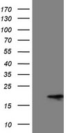 MMGT1 Antibody - HEK293T cells were transfected with the pCMV6-ENTRY control. (Left lane) or pCMV6-ENTRY MMGT1. (Right lane) cDNA for 48 hrs and lysed. Equivalent amounts of cell lysates. (5 ug per lane) were separated by SDS-PAGE and immunoblotted with anti-MMGT1. (1:2000)