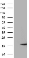 MMGT1 Antibody - HEK293T cells were transfected with the pCMV6-ENTRY control. (Left lane) or pCMV6-ENTRY MMGT1. (Right lane) cDNA for 48 hrs and lysed. Equivalent amounts of cell lysates. (5 ug per lane) were separated by SDS-PAGE and immunoblotted with anti-MMGT1. (1:2000)