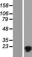 MMGT1 Protein - Western validation with an anti-DDK antibody * L: Control HEK293 lysate R: Over-expression lysate