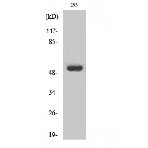 MMP1 Antibody - Western blot of MMP-1 antibody