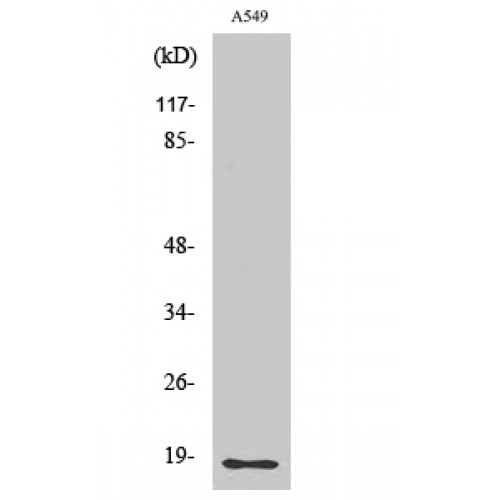 MMP1 Antibody - Western blot of Cleaved-MMP-1 22k (F100) antibody