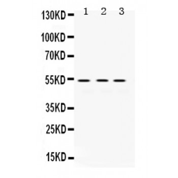 MMP1 Antibody - MMP1 antibody Western blot. All lanes: Anti MMP1 at 0.5 ug/ml. Lane 1: SMMC Whole Cell Lysate at 40 ug. Lane 2: 22RV1 Whole Cell Lysate at 40 ug. Lane 3: MCF-7 Whole Cell Lysate at 40 ug. Predicted band size: 54 kD. Observed band size: 54 kD.