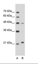 MMP1 Antibody - A: Marker, B: Jurkat Cell Lysate.  This image was taken for the unconjugated form of this product. Other forms have not been tested.