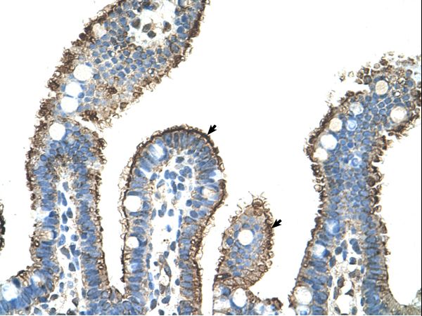 MMP1 Antibody - MMP1 antibody ARP42039_T100-NP_002412-MMP1(matrix metallopeptidase 1 (interstitial collagenase)) Antibody was used in IHC to stain formalin-fixed, paraffin-embedded human intestine.  This image was taken for the unconjugated form of this product. Other forms have not been tested.