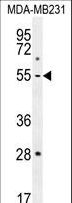 MMP1 Antibody - MMP1 Antibody western blot of MDA-MB231 cell line lysates (35 ug/lane). The MMP1 antibody detected the MMP1 protein (arrow).