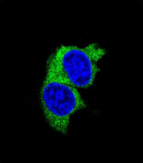 MMP1 Antibody - Confocal immunofluorescence of MMP1 Antibody with MDA-MB231 cell followed by Alexa Fluor 488-conjugated goat anti-rabbit lgG (green). DAPI was used to stain the cell nuclear (blue).