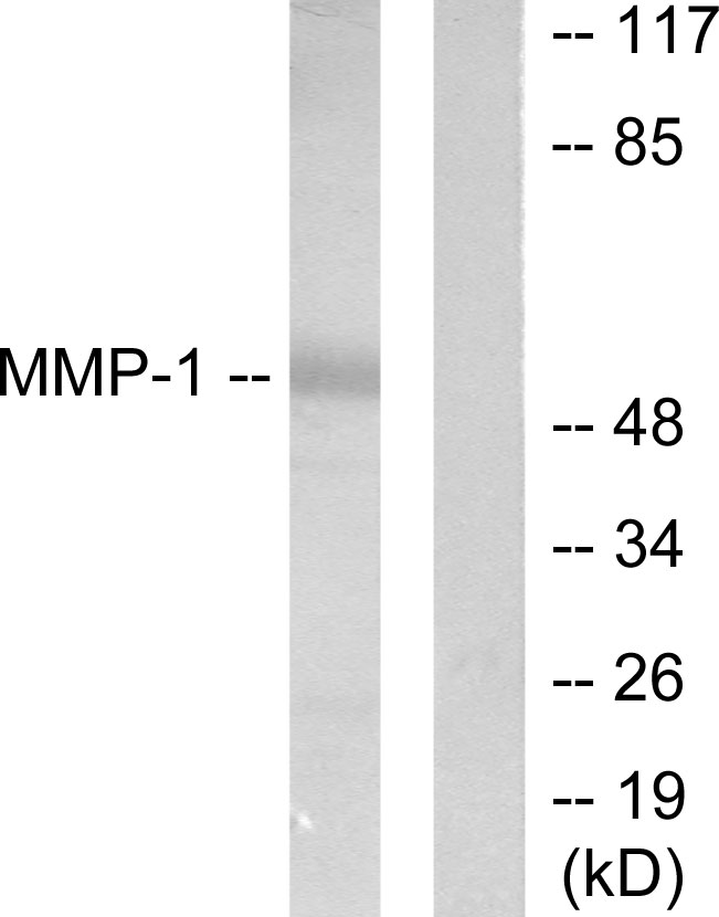 MMP1 Antibody - Western blot analysis of lysates from HepG2 cells, using MMP-1 Antibody. The lane on the right is blocked with the synthesized peptide.