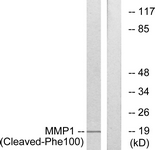MMP1 Antibody - Western blot of extracts from A549 cells, treated with etoposide 25 uM 24h, using MMP1 (Cleaved-Phe100) Antibody. The lane on the right is treated with the synthesized peptide.