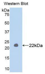 MMP1 Antibody - Western blot of recombinant MMP1 / MMP-1.  This image was taken for the unconjugated form of this product. Other forms have not been tested.