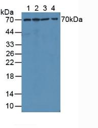 MMP1 Antibody - Western Blot; Sample: Lane1: Human A549 Cells; Lane2: Human HepG2 Cells; Lane3: Human Jurkat Cells; Lane4: Human Liver Tissue.