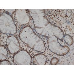 MMP1 Antibody - Immunohistochemistry of paraffin-embedded normal human colon with Mouse anti-Human MMP-1 after citrate retrieval