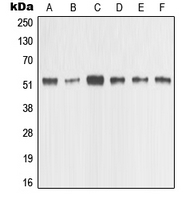 MMP1 Antibody - Western blot analysis of MMP1 expression in HeLa (A); MCF7 (B); MDAMB435 (C); Raw264.7 (D); PC12 (E); NIH3T3 (F) whole cell lysates.