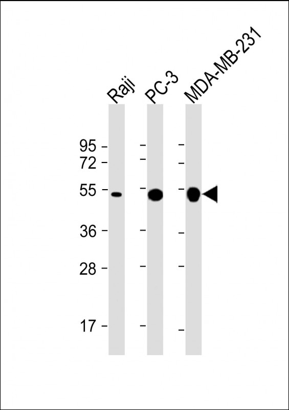 MMP1 Antibody - All lanes: Anti-MMP1 Antibody at 1:2000 dilution Lane 1: Raji whole cell lysate Lane 2: PC-3 whole cell lysate Lane 3: MDA-MB-231 whole cell lysate Lysates/proteins at 20 µg per lane. Secondary Goat Anti-mouse IgG, (H+L), Peroxidase conjugated at 1/10000 dilution. Predicted band size: 52/55 kDa Blocking/Dilution buffer: 5% NFDM/TBST.