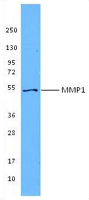 MMP1 Antibody - Recombinant MMP1 was resolved by electrophoresis, transferred to nitrocellulose, and probed with purified anti-MMP1 antibody (clone F15P3B6). Proteins were visualized using a goat anti-mouse IgG secondary conjugated to HRP and chemiluminescence detection.