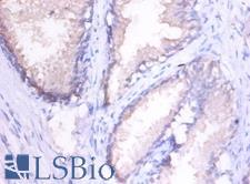 MMP1 Antibody - Immunohistochemistry of paraffin-embedded human spleen using MMP1 antibody at dilution of 1:100.  This image was taken for the unconjugated form of this product. Other forms have not been tested.