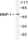 MMP1 Antibody - Western blot of MMP-1 (H440) pAb in extracts from HepG2 cells.