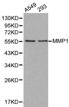 MMP1 Antibody - Western blot of MMP1 pAb in extracts from A549 and 293 cells.