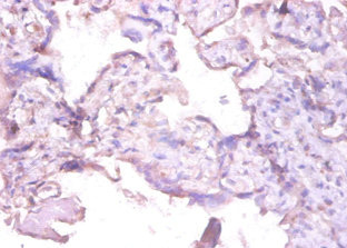 MMP1 Antibody - Immunohistochemistry of paraffin-embedded human placenta tissue using MMP1 Antibody at dilution of 1:100