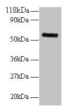 MMP1 Antibody - Western blot All lanes: Interstitial collagenase antibody at 2µg/ml + 293T whole cell lysate Secondary Goat polyclonal to rabbit IgG at 1/10000 dilution Predicted band size: 51 kDa Observed band size: 51 kDa