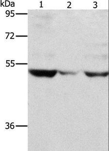 MMP1 Antibody - Western blot analysis of PC3 cell and mouse muscle tissue, A375 cell, using MMP1 Polyclonal Antibody at dilution of 1:500.