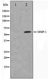 MMP1 Antibody - Western blot of HepG2 cell lysate using MMP1 Antibody