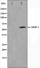 MMP1 Antibody - Western blot analysis on HepG2 cell lysates using MMP1 antibody. The lane on the left is treated with the antigen-specific peptide.