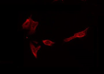 MMP1 Antibody - Staining HepG2 cells by IF/ICC. The samples were fixed with PFA and permeabilized in 0.1% Triton X-100, then blocked in 10% serum for 45 min at 25°C. The primary antibody was diluted at 1:200 and incubated with the sample for 1 hour at 37°C. An Alexa Fluor 594 conjugated goat anti-rabbit IgG (H+L) Ab, diluted at 1/600, was used as the secondary antibody.