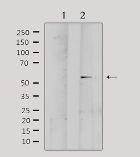 MMP1 Antibody - Western blot analysis of extracts of HeLa cells using MMP1 antibody. Lane 1 was treated with the antigen-specific peptide.