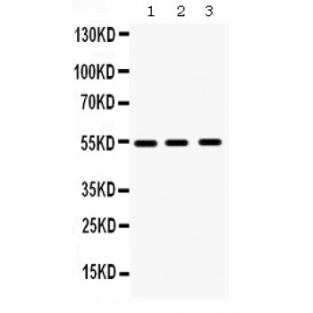 MMP10 Antibody - MMP10 antibody Western blot. All lanes: Anti MMP10 at 0.5 ug/ml. Lane 1: Human Placenta Tissue Lysate at 50 ug. Lane 2: HELA Whole Cell Lysate at 40 ug. Lane 3: SGC Whole Cell Lysate at 40 ug. Predicted band size: 54 kD. Observed band size: 54 kD.