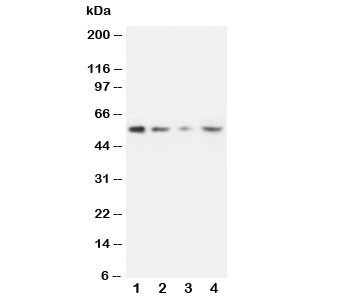 MMP10 Antibody - Western blot testing of MMP10 antibody and Lane 1: recombinant human protein 10ng; 2: 5ng; 3: 2.5ng; 4: HeLa