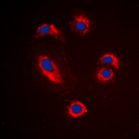 MMP10 Antibody - Immunofluorescent analysis of MMP10 staining in Jurkat cells. Formalin-fixed cells were permeabilized with 0.1% Triton X-100 in TBS for 5-10 minutes and blocked with 3% BSA-PBS for 30 minutes at room temperature. Cells were probed with the primary antibody in 3% BSA-PBS and incubated overnight at 4 deg C in a humidified chamber. Cells were washed with PBST and incubated with a DyLight 594-conjugated secondary antibody (red) in PBS at room temperature in the dark. DAPI was used to stain the cell nuclei (blue).