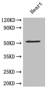 MMP10 Antibody - Western Blot Positive WB detected in: Mouse heart All lanes: MMP10 antibody at 4.5µg/ml Secondary Goat polyclonal to rabbit IgG at 1/50000 dilution Predicted band size: 54 kDa Observed band size: 54 kDa