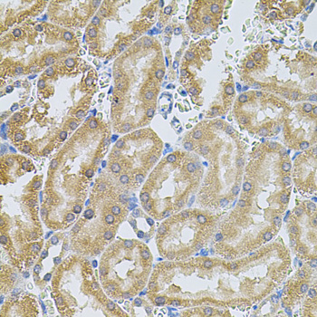 MMP10 Antibody - Immunohistochemistry of paraffin-embedded rat kidney tissue.