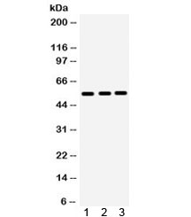 MMP10 Antibody