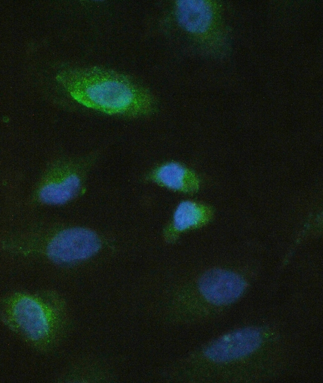 MMP10 Antibody - IF analysis of MMP10 using anti-MMP10 antibody. MMP10 was detected in immunocytochemical section of A549 cell. Enzyme antigen retrieval was performed using IHC enzyme antigen retrieval reagent for 15 mins. The tissue section was blocked with 10% goat serum. The tissue section was then incubated with 2µg/mL rabbit anti-MMP10 Antibody overnight at 4°C. DyLight®488 Conjugated Goat Anti-Rabbit IgG was used as secondary antibody at 1:100 dilution and incubated for 30 minutes at 37°C. The section was counterstained with DAPI. isualize using a fluorescence microscope and filter sets appropriate for the label used.