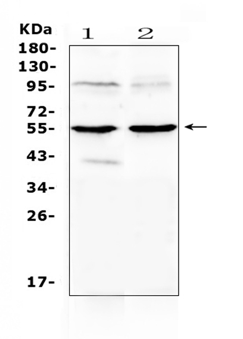 MMP10 Antibody - Western blot analysis of MMP10 using anti-MMP10 antibody. Electrophoresis was performed on a 5-20% SDS-PAGE gel at 70V (Stacking gel) / 90V (Resolving gel) for 2-3 hours. The sample well of each lane was loaded with 50ug of sample under reducing conditions. Lane 1: rat cardiac muscle tissue lysates, Lane 2: mouse cardiac muscle tissue lysates. After Electrophoresis, proteins were transferred to a Nitrocellulose membrane at 150mA for 50-90 minutes. Blocked the membrane with 5% Non-fat Milk/ TBS for 1.5 hour at RT. The membrane was incubated with rabbit anti-MMP10 antigen affinity purified polyclonal antibody at 0.5 µg/mL overnight at 4°C, then washed with TBS-0.1% Tween 3 times with 5 minutes each and probed with a goat anti-rabbit IgG-HRP secondary antibody at a dilution of 1:10000 for 1.5 hour at RT. The signal is developed using an Enhanced Chemiluminescent detection (ECL) kit with Tanon 5200 system. A specific band was detected for MMP10 at approximately 54KD. The expected band size for MMP10 is at 54KD.