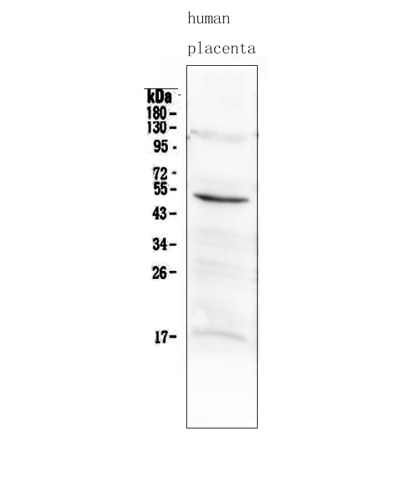 MMP10 Antibody - Western blot analysis of MMP10 using anti-MMP10 antibody. Electrophoresis was performed on a 5-20% SDS-PAGE gel at 70V (Stacking gel) / 90V (Resolving gel) for 2-3 hours. The sample well of each lane was loaded with 50ug of sample under reducing conditions. Lane 1: human placenta tissue lysates. After Electrophoresis, proteins were transferred to a Nitrocellulose membrane at 150mA for 50-90 minutes. Blocked the membrane with 5% Non-fat Milk/ TBS for 1.5 hour at RT. The membrane was incubated with rabbit anti-MMP10 antigen affinity purified polyclonal antibody at 0.5 µg/mL overnight at 4°C, then washed with TBS-0.1% Tween 3 times with 5 minutes each and probed with a goat anti-rabbit IgG-HRP secondary antibody at a dilution of 1:10000 for 1.5 hour at RT. The signal is developed using an Enhanced Chemiluminescent detection (ECL) kit with Tanon 5200 system. A specific band was detected for MMP10 at approximately 54KD. The expected band size for MMP10 is at 54KD.