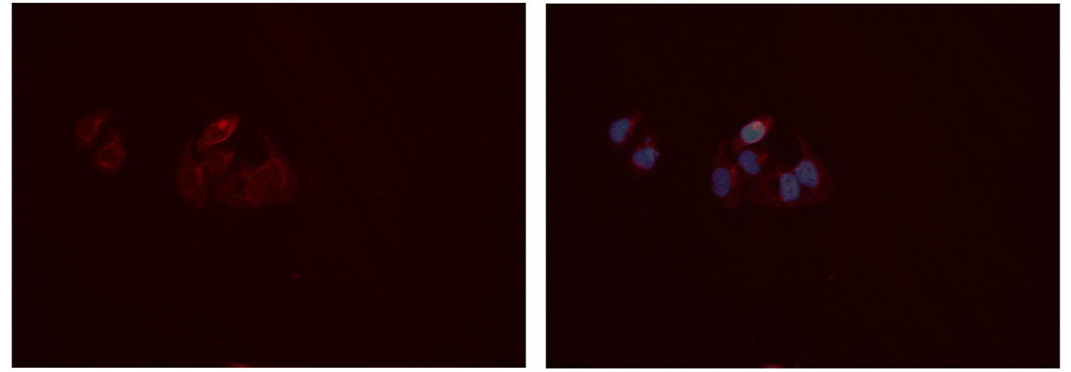 MMP10 Antibody - Staining HeLa cells by IF/ICC. The samples were fixed with PFA and permeabilized in 0.1% Triton X-100, then blocked in 10% serum for 45 min at 25°C. The primary antibody was diluted at 1:200 and incubated with the sample for 1 hour at 37°C. An Alexa Fluor 594 conjugated goat anti-rabbit IgG (H+L) antibody, diluted at 1/600 was used as secondary antibody.