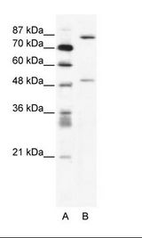 MMP10 Antibody - A: Marker, B: Jurkat Cell Lysate.  This image was taken for the unconjugated form of this product. Other forms have not been tested.