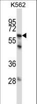 MMP11 Antibody - MMP11 Antibody western blot of K562 cell line lysates (35 ug/lane). The MMP11 antibody detected the MMP11 protein (arrow).