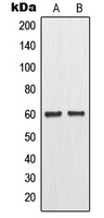 MMP11 Antibody - Western blot analysis of MMP11 expression in MCF7 (A); Raw264.7 (B) whole cell lysates.