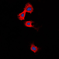MMP11 Antibody - Immunofluorescent analysis of MMP11 staining in Raw264.7 cells. Formalin-fixed cells were permeabilized with 0.1% Triton X-100 in TBS for 5-10 minutes and blocked with 3% BSA-PBS for 30 minutes at room temperature. Cells were probed with the primary antibody in 3% BSA-PBS and incubated overnight at 4 C in a humidified chamber. Cells were washed with PBST and incubated with a DyLight 594-conjugated secondary antibody (red) in PBS at room temperature in the dark. DAPI was used to stain the cell nuclei (blue).